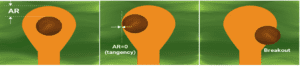 pcb-annular-ring-tangency-and-breakout.jpg